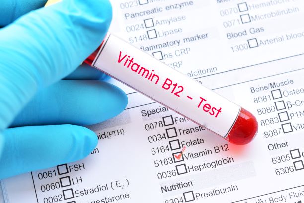 Vitamin B12 test